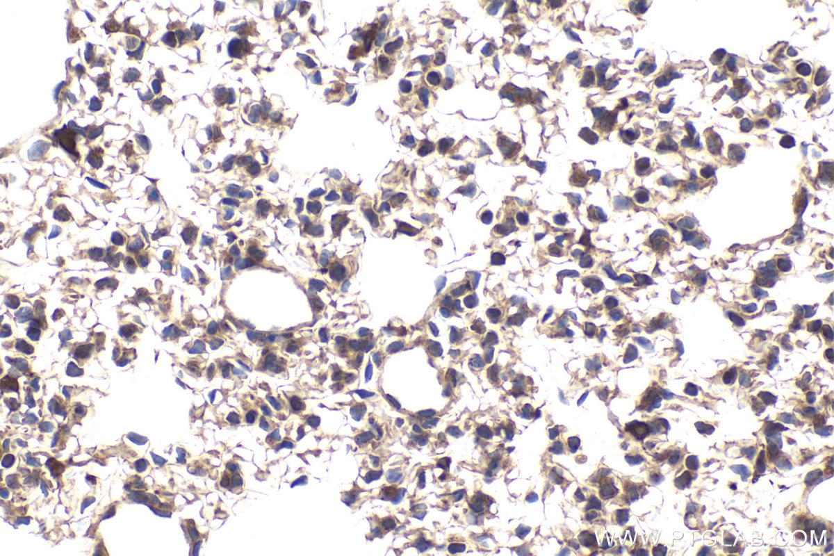 Immunohistochemical analysis of paraffin-embedded mouse lung tissue slide using KHC1890 (DNAJC2/ZRF1 IHC Kit).
