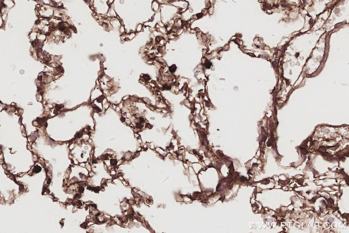 Immunohistochemical analysis of paraffin-embedded rat lung tissue slide using KHC2914 (DNAJC5 IHC Kit).