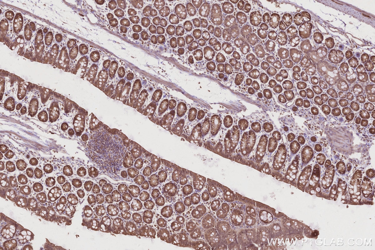 Immunohistochemical analysis of paraffin-embedded mouse colon tissue slide using KHC2844 (DNAJC7 IHC Kit).
