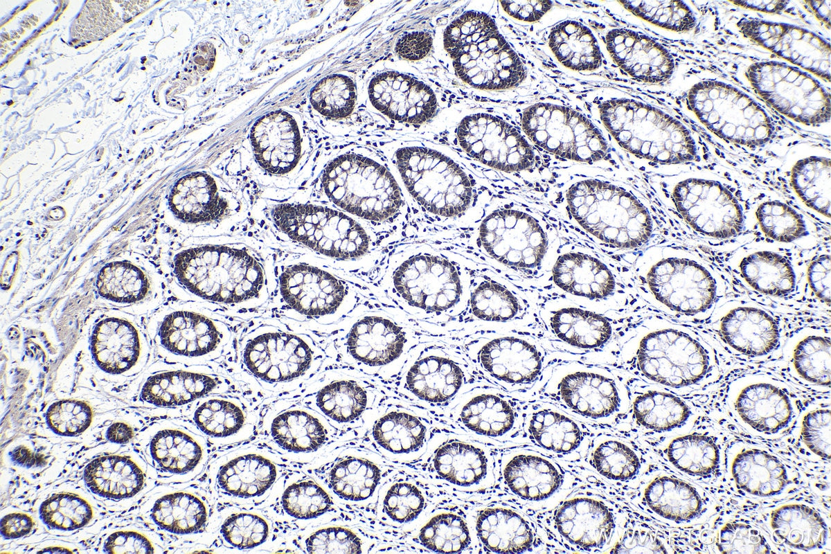 Immunohistochemical analysis of paraffin-embedded human colon tissue slide using KHC1129 (DNAJC9 IHC Kit).