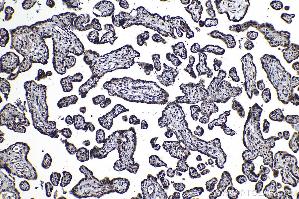 Immunohistochemical analysis of paraffin-embedded human placenta tissue slide using KHC1129 (DNAJC9 IHC Kit).