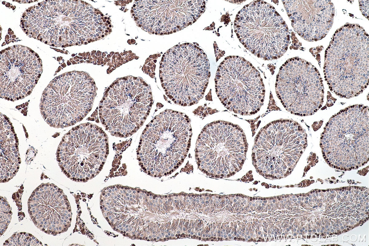 Immunohistochemical analysis of paraffin-embedded mouse testis tissue slide using KHC0174 (DNMT3A IHC Kit).