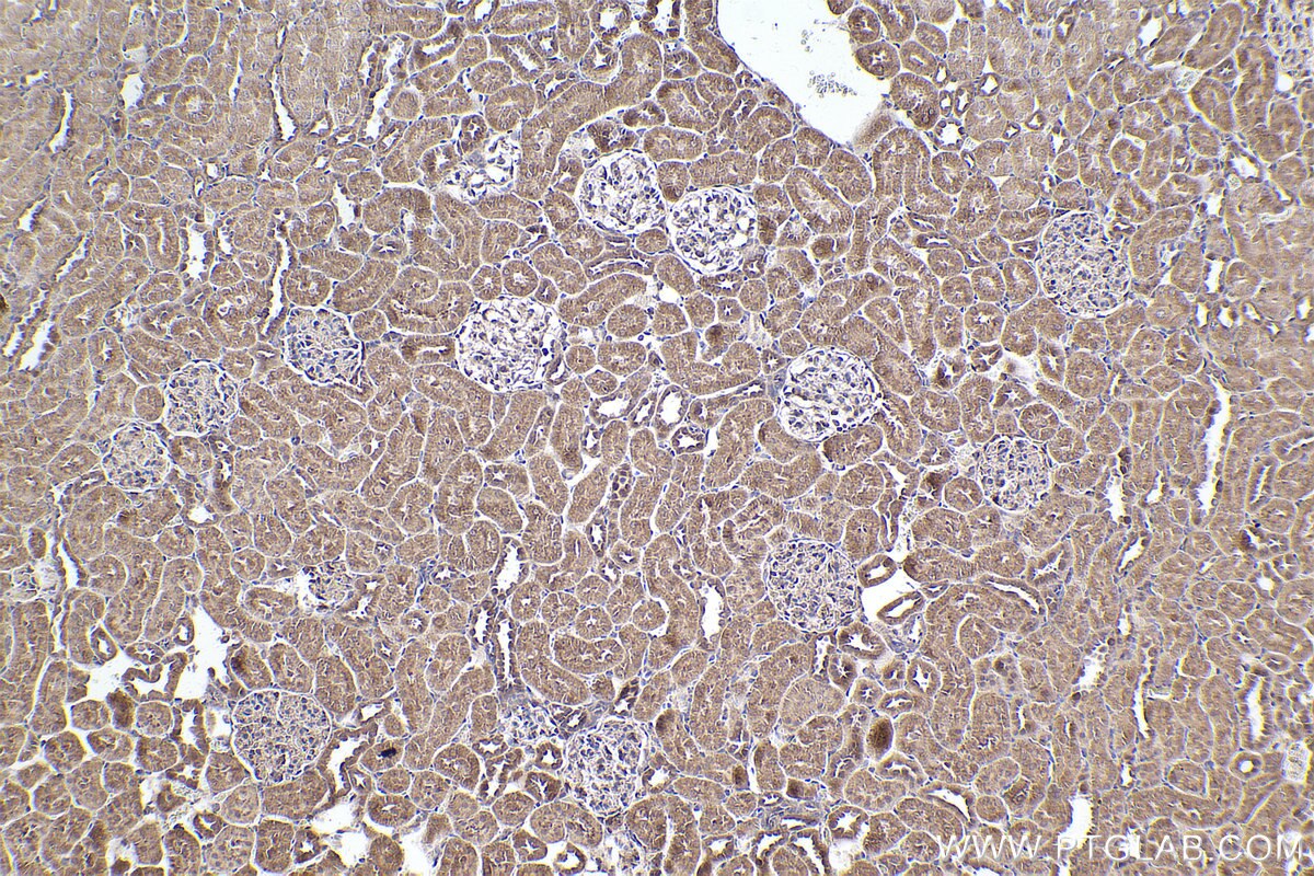 Immunohistochemical analysis of paraffin-embedded rat kidney tissue slide using KHC2544 (DOCK11 IHC Kit).