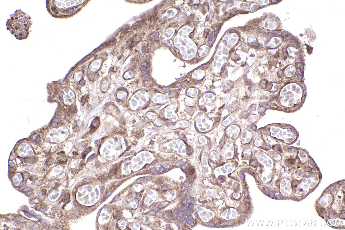 Immunohistochemical analysis of paraffin-embedded human placenta tissue slide using KHC2544 (DOCK11 IHC Kit).