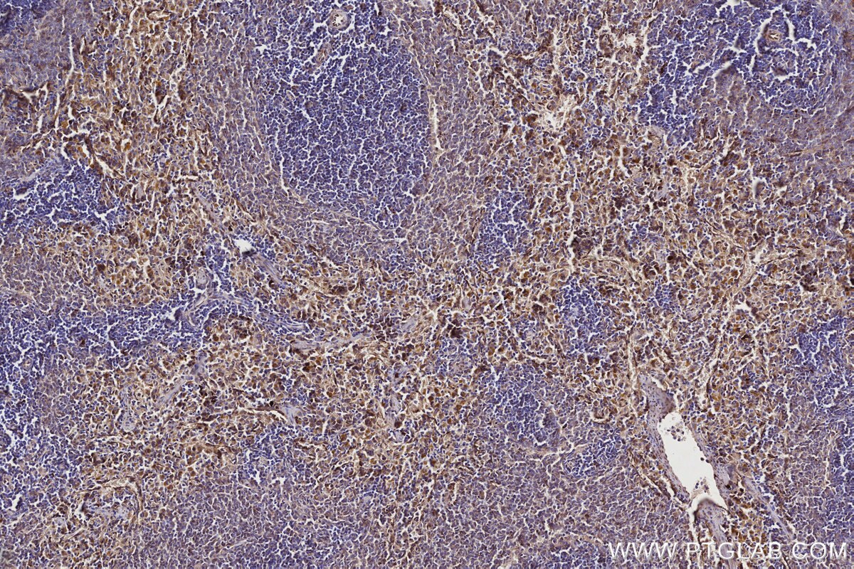 Immunohistochemical analysis of paraffin-embedded rat spleen tissue slide using KHC2747 (DOCK2 IHC Kit).