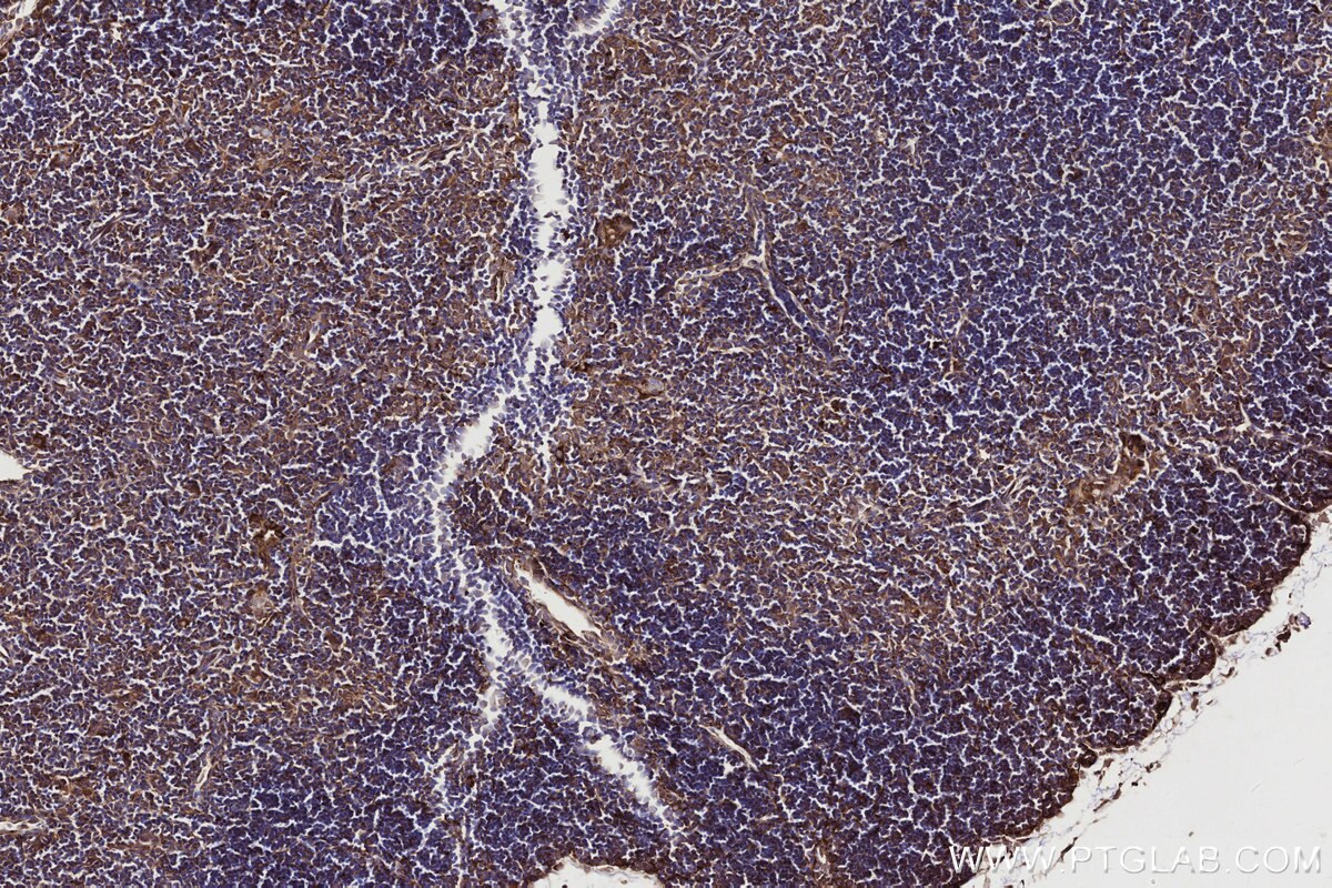 Immunohistochemical analysis of paraffin-embedded mouse thymus tissue slide using KHC2747 (DOCK2 IHC Kit).