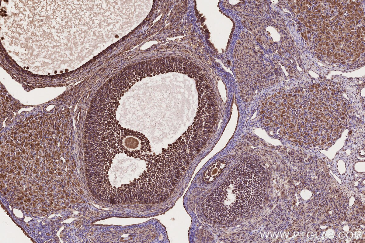 Immunohistochemical analysis of paraffin-embedded rat ovary tissue slide using KHC2668 (DOCK4 IHC Kit).