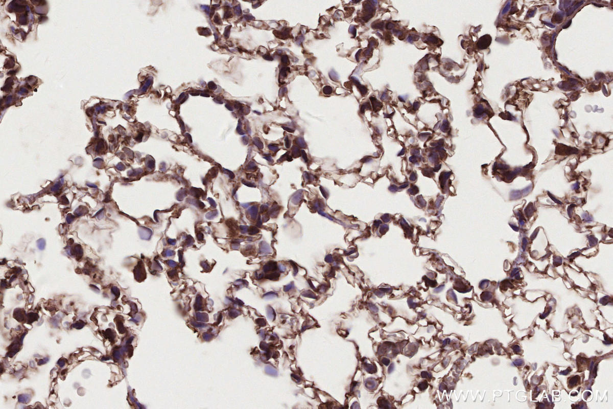Immunohistochemical analysis of paraffin-embedded rat lung tissue slide using KHC2668 (DOCK4 IHC Kit).