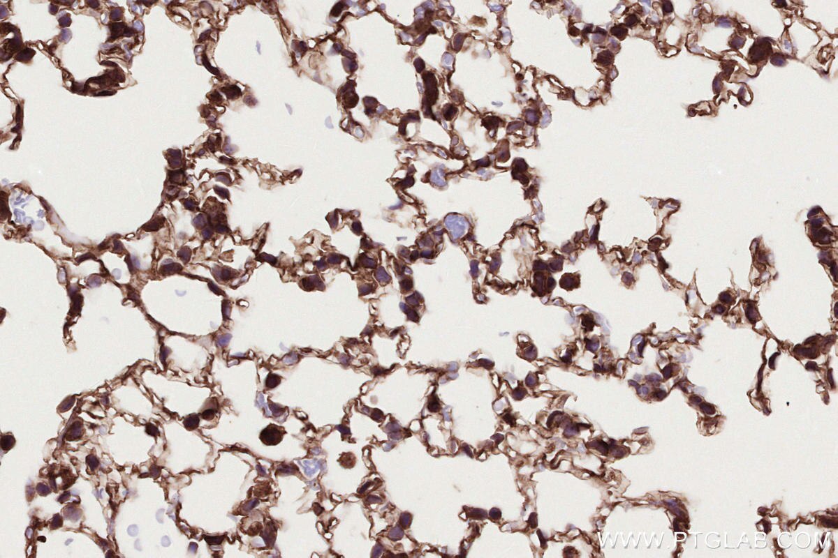 Immunohistochemical analysis of paraffin-embedded mouse lung tissue slide using KHC2668 (DOCK4 IHC Kit).