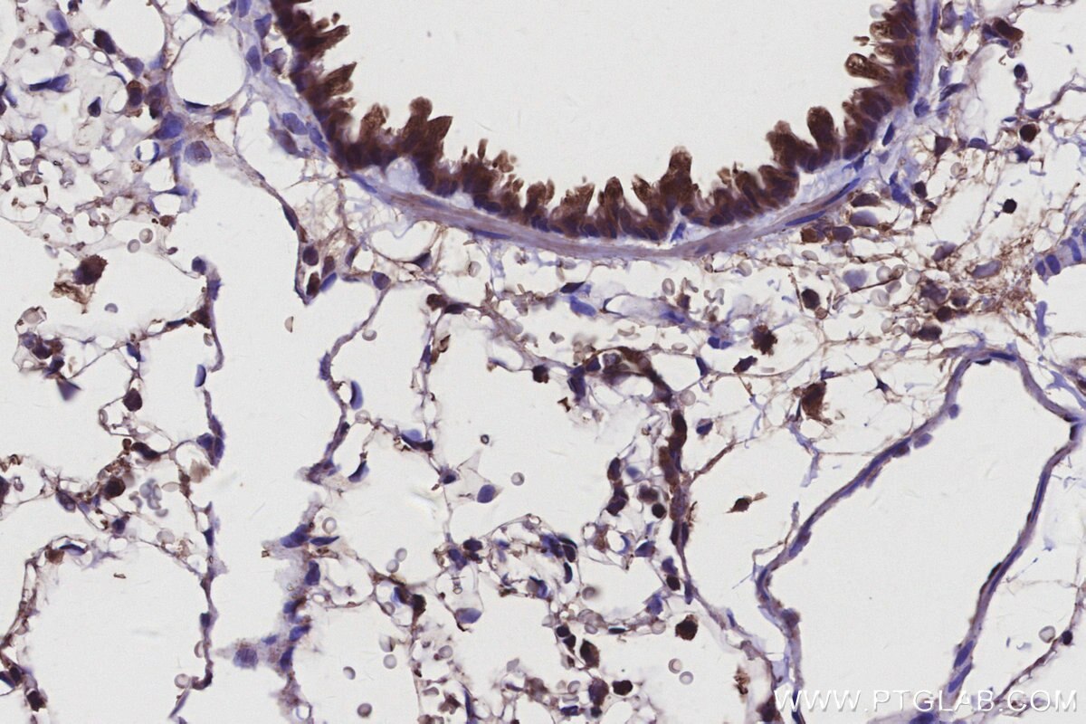Immunohistochemical analysis of paraffin-embedded rat lung tissue slide using KHC2924 (DOCK5 IHC Kit).