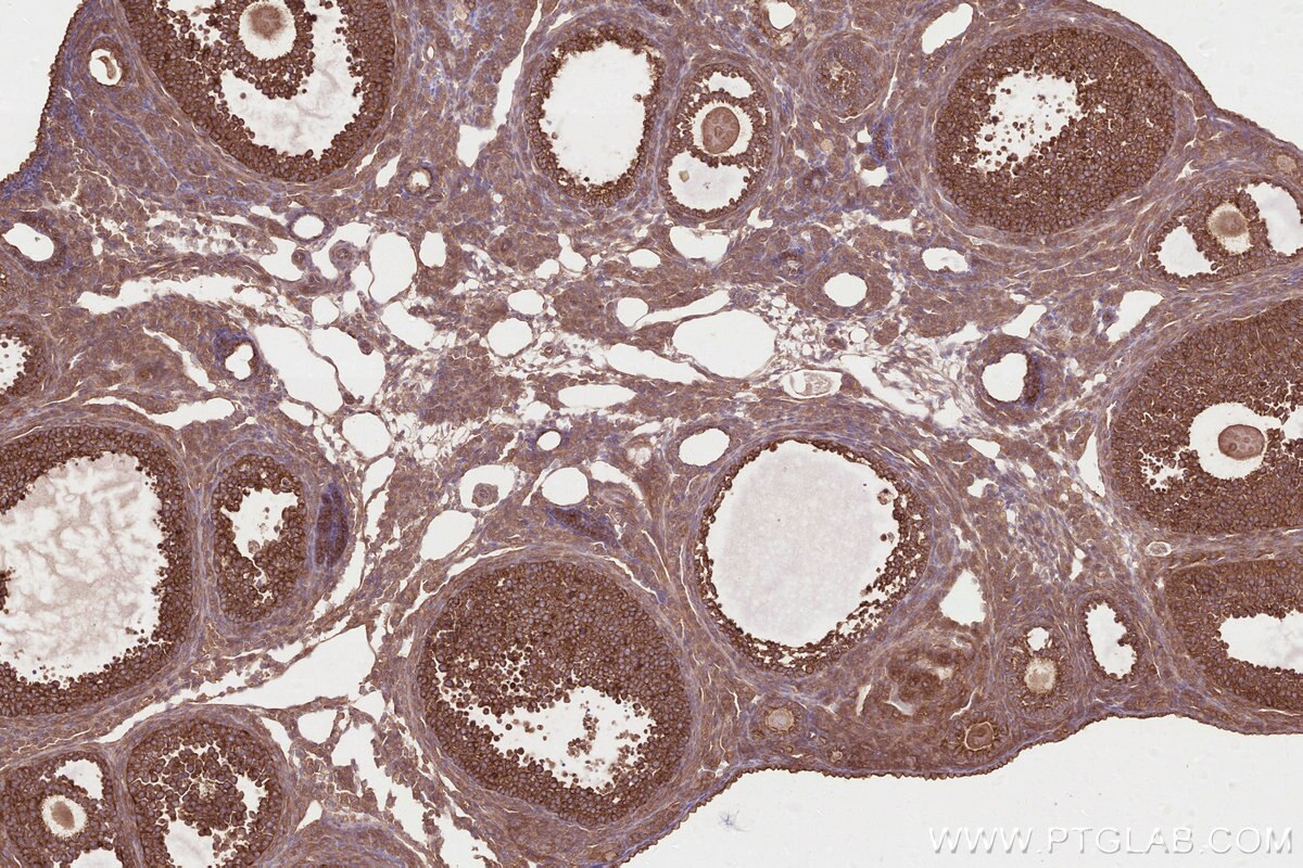 Immunohistochemical analysis of paraffin-embedded mouse ovary tissue slide using KHC2809 (DOCK7 IHC Kit).