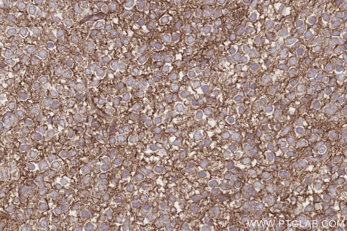 Immunohistochemical analysis of paraffin-embedded mouse embryo tissue slide using KHC2809 (DOCK7 IHC Kit).