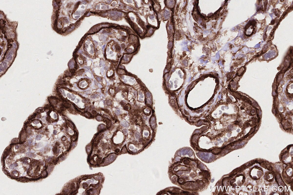Immunohistochemical analysis of paraffin-embedded human placenta tissue slide using KHC2694 (DOCK8 IHC Kit).