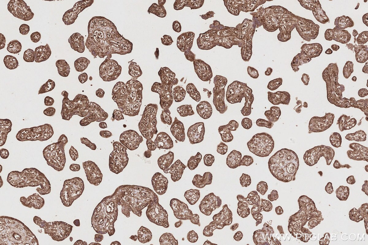 Immunohistochemical analysis of paraffin-embedded human placenta tissue slide using KHC2889 (DOCK9 IHC Kit).