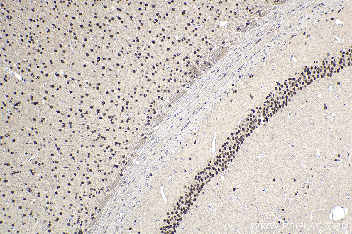 Immunohistochemical analysis of paraffin-embedded mouse brain tissue slide using KHC1854 (DPF1 IHC Kit).