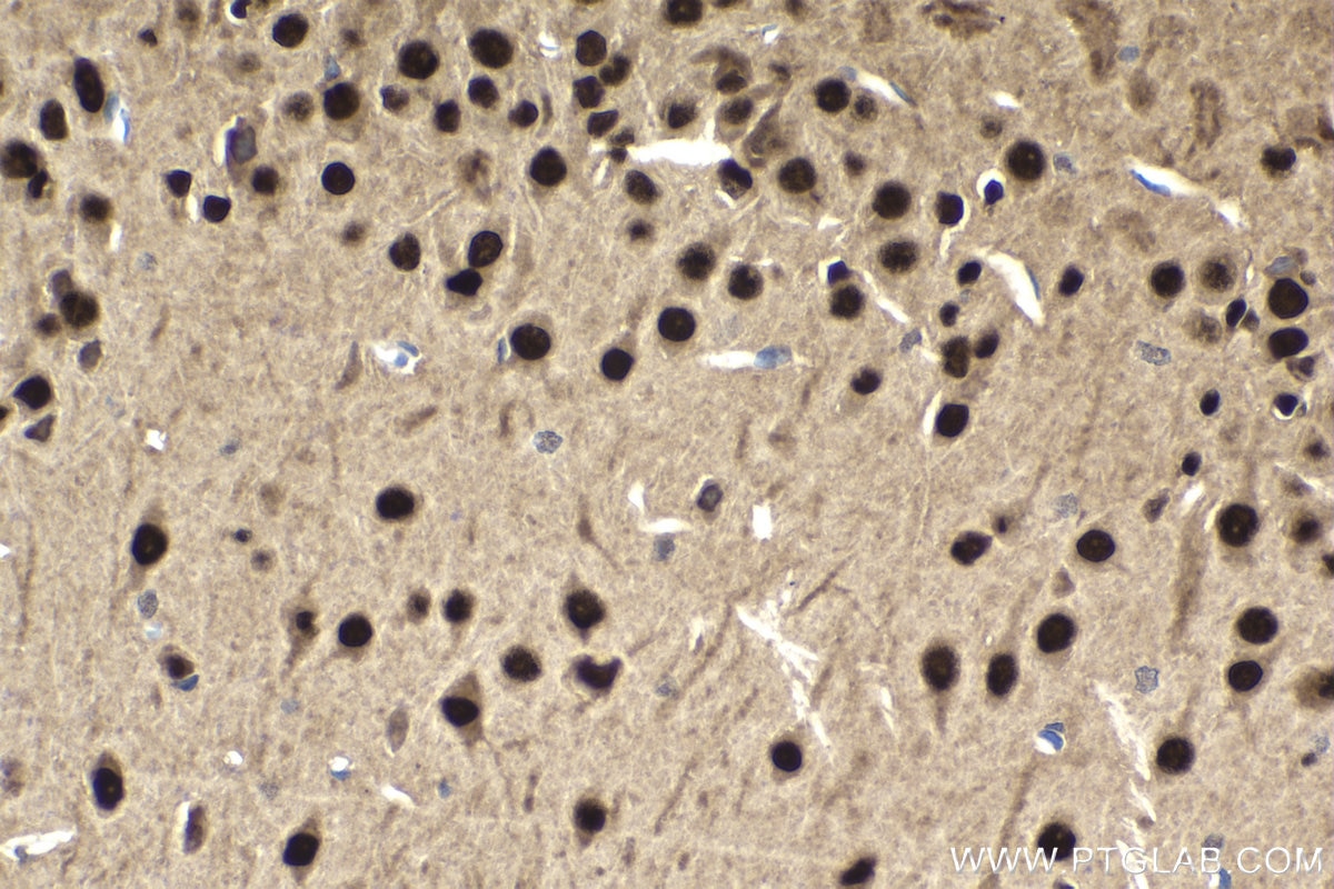 Immunohistochemical analysis of paraffin-embedded rat brain tissue slide using KHC1854 (DPF1 IHC Kit).