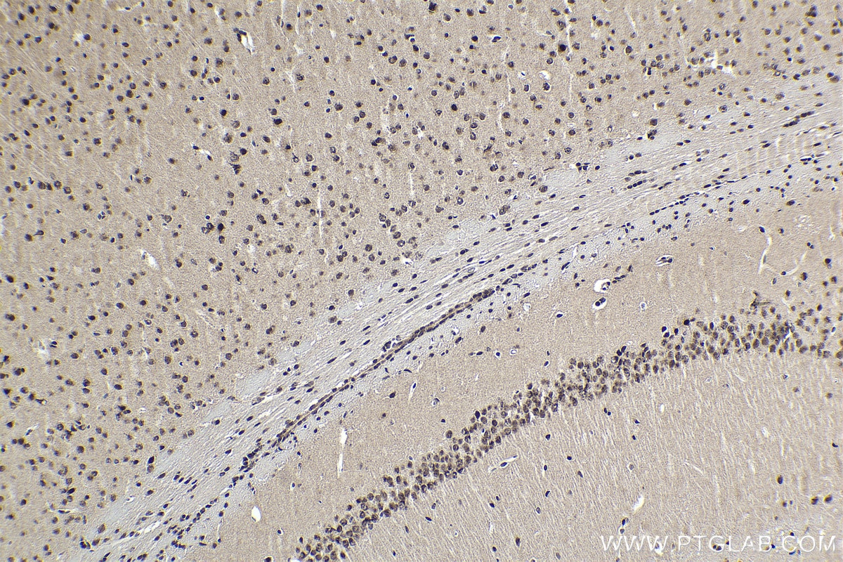 Immunohistochemical analysis of paraffin-embedded mouse brain tissue slide using KHC1855 (DPF2 IHC Kit).