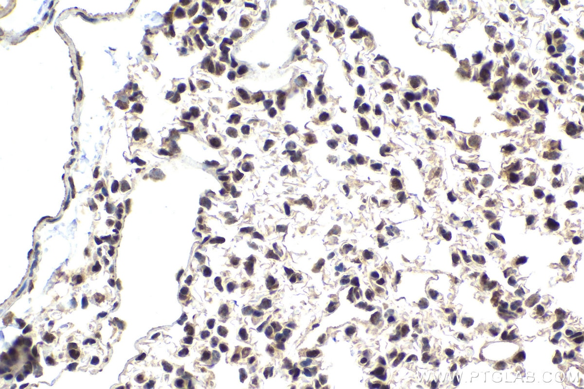 Immunohistochemical analysis of paraffin-embedded mouse lung tissue slide using KHC1855 (DPF2 IHC Kit).