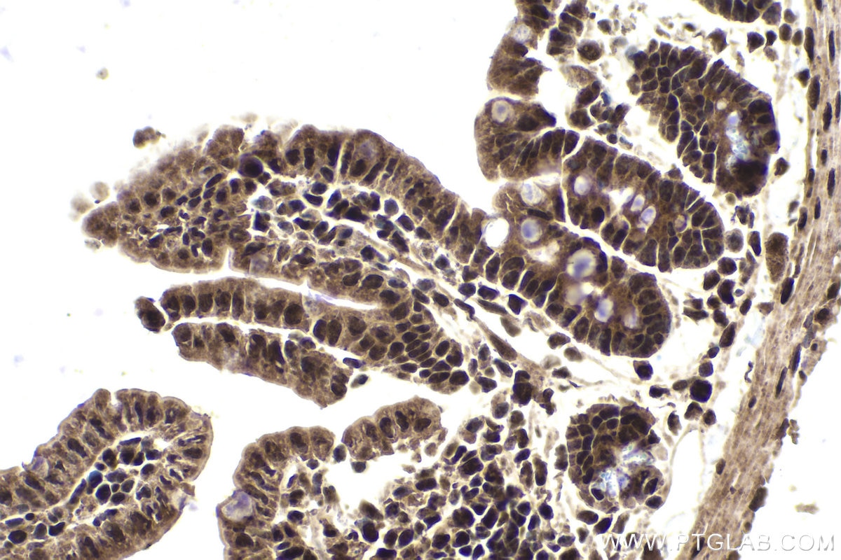 Immunohistochemical analysis of paraffin-embedded mouse small intestine tissue slide using KHC1855 (DPF2 IHC Kit).