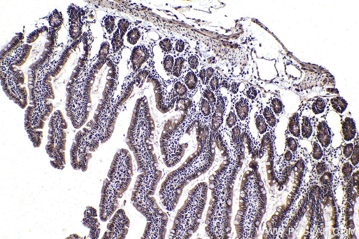 Immunohistochemical analysis of paraffin-embedded rat small intestine tissue slide using KHC1855 (DPF2 IHC Kit).