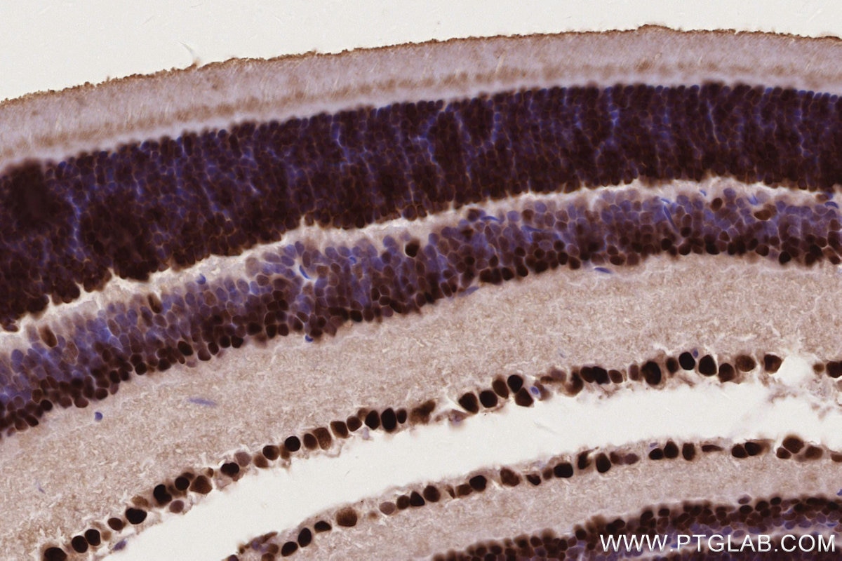 Immunohistochemical analysis of paraffin-embedded mouse eye tissue slide using KHC2755 (DPF3 IHC Kit).