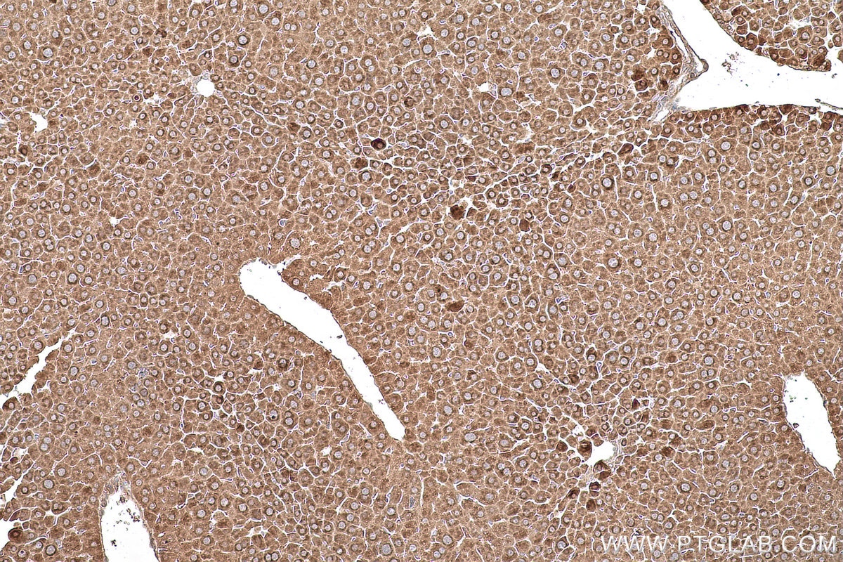 Immunohistochemical analysis of paraffin-embedded mouse liver tissue slide using KHC0824 (DPYD IHC Kit).