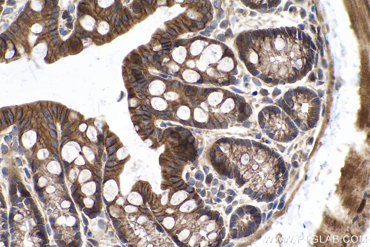 Immunohistochemical analysis of paraffin-embedded mouse colon tissue slide using KHC0731 (DPYSL2 IHC Kit).