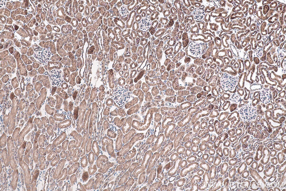 Immunohistochemical analysis of paraffin-embedded mouse kidney tissue slide using KHC0822 (DRG1 IHC Kit).