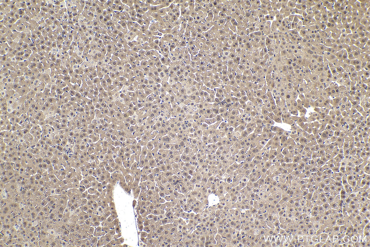Immunohistochemical analysis of paraffin-embedded mouse liver tissue slide using KHC1637 (DSS1 IHC Kit).