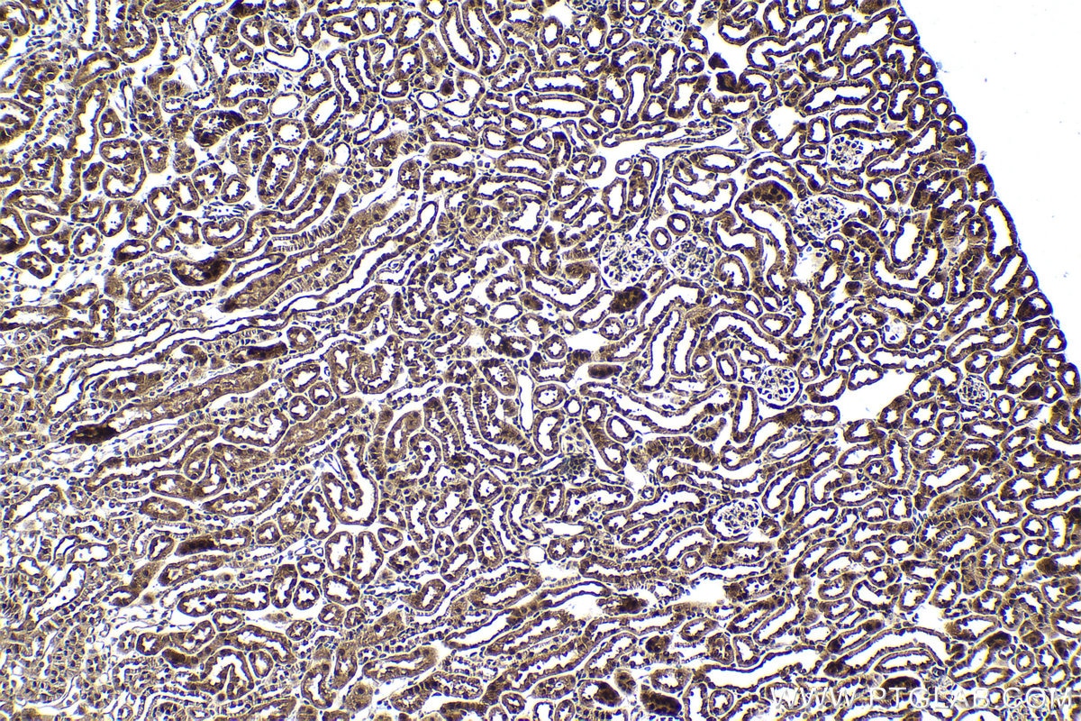 Immunohistochemical analysis of paraffin-embedded mouse kidney tissue slide using KHC1637 (DSS1 IHC Kit).