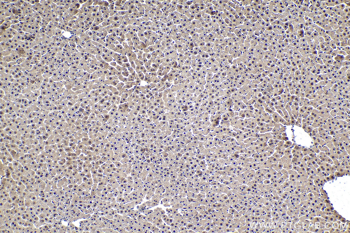 Immunohistochemical analysis of paraffin-embedded rat liver tissue slide using KHC1637 (DSS1 IHC Kit).