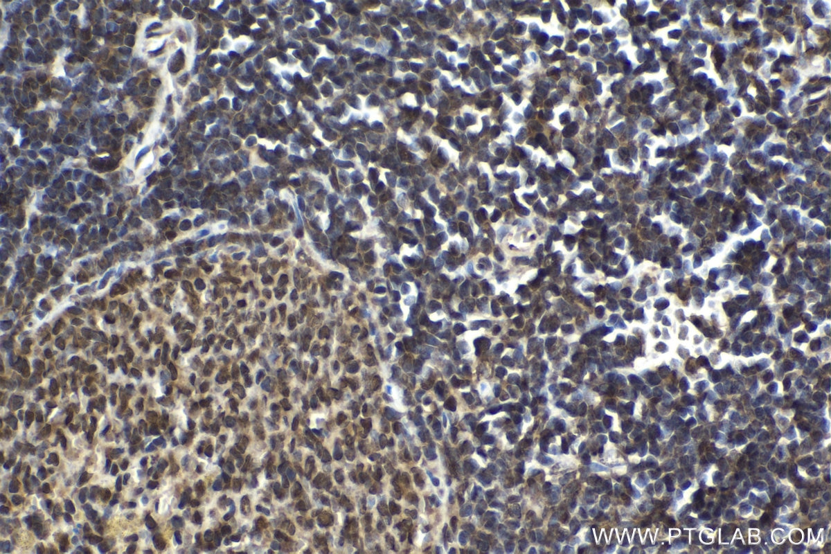 Immunohistochemical analysis of paraffin-embedded rat spleen tissue slide using KHC1637 (DSS1 IHC Kit).