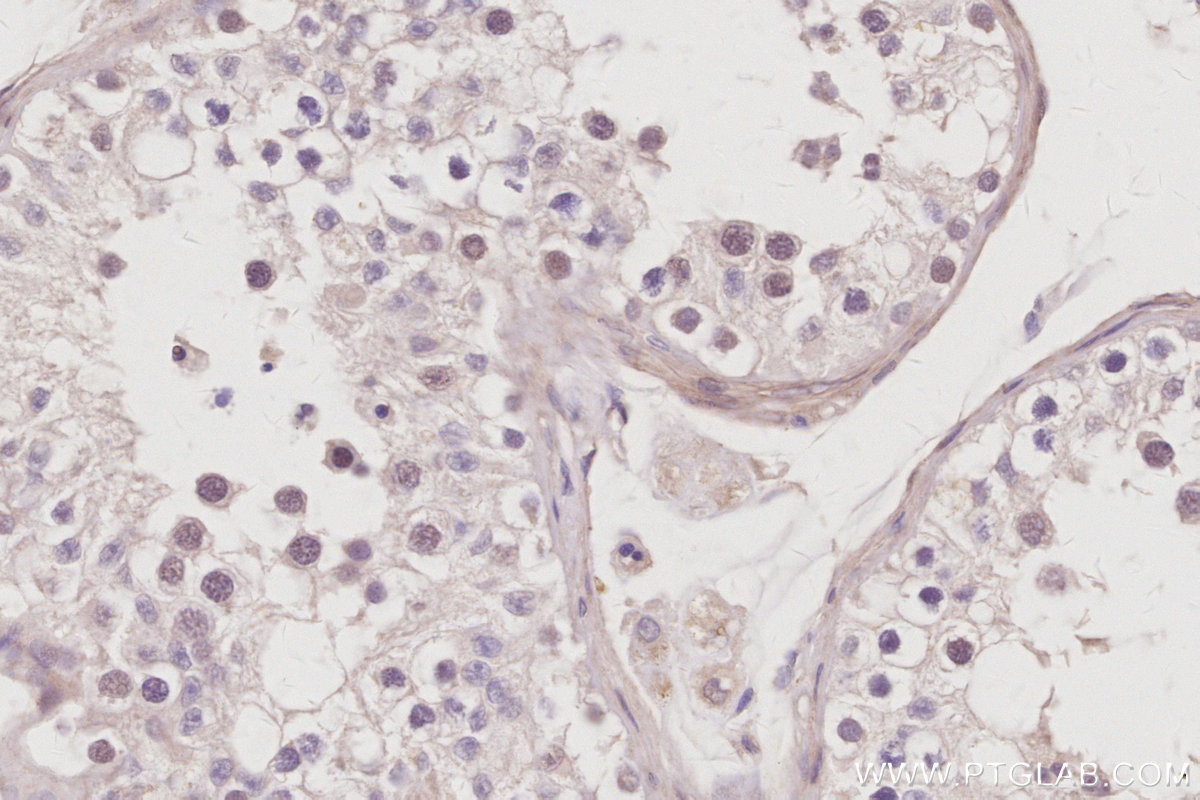 Immunohistochemical analysis of paraffin-embedded human testis tissue slide using KHC2979 (DTL IHC Kit).