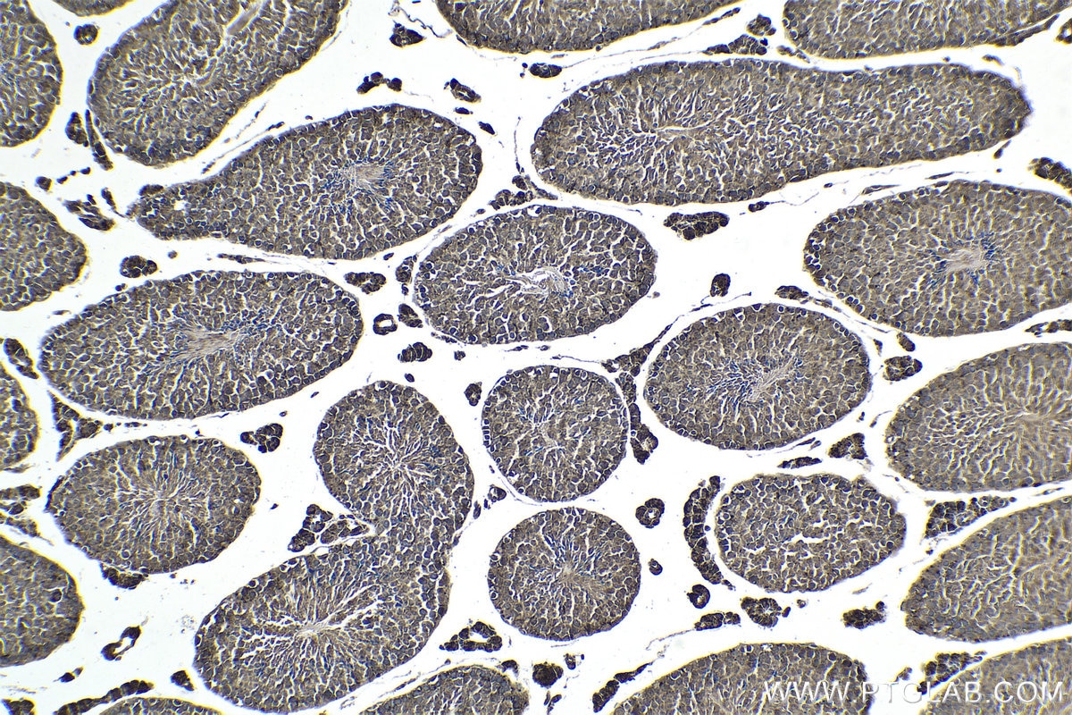 Immunohistochemical analysis of paraffin-embedded mouse testis tissue slide using KHC1811 (DTX1 IHC Kit).