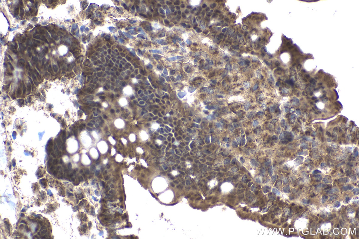 Immunohistochemical analysis of paraffin-embedded rat small intestine tissue slide using KHC1811 (DTX1 IHC Kit).