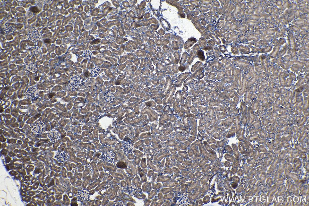 Immunohistochemical analysis of paraffin-embedded mouse kidney tissue slide using KHC1403 (DTYMK IHC Kit).