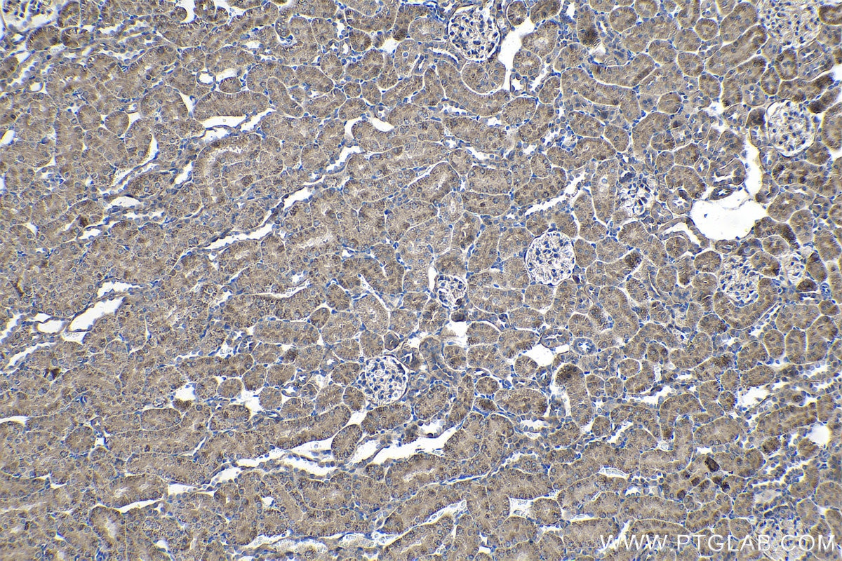 Immunohistochemical analysis of paraffin-embedded rat kidney tissue slide using KHC1403 (DTYMK IHC Kit).