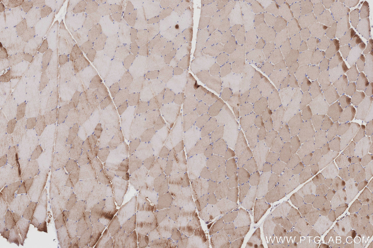 Immunohistochemical analysis of paraffin-embedded rat skeletal muscle tissue slide using KHC3014 (DUSP13 IHC Kit).