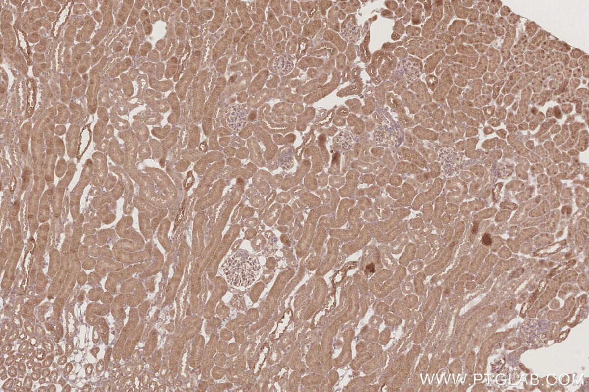 Immunohistochemical analysis of paraffin-embedded mouse kidney tissue slide using KHC2885 (DUSP16 IHC Kit).