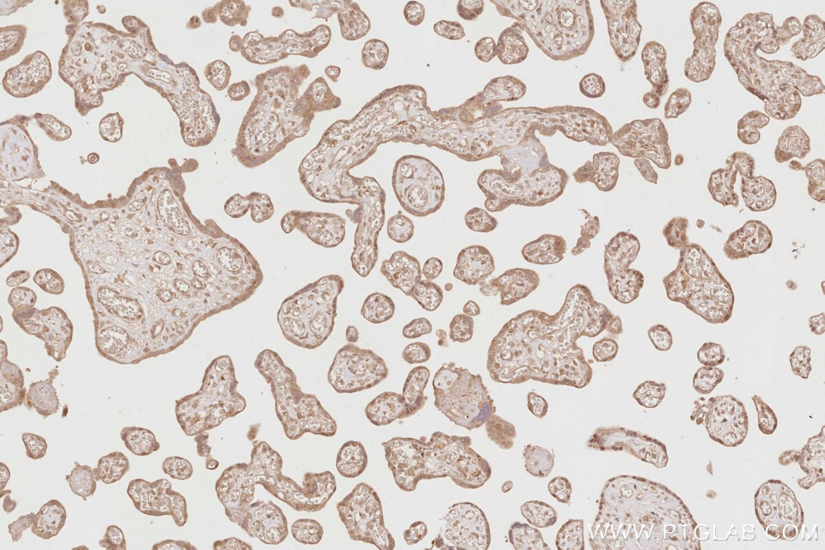 Immunohistochemical analysis of paraffin-embedded human placenta tissue slide using KHC2885 (DUSP16 IHC Kit).