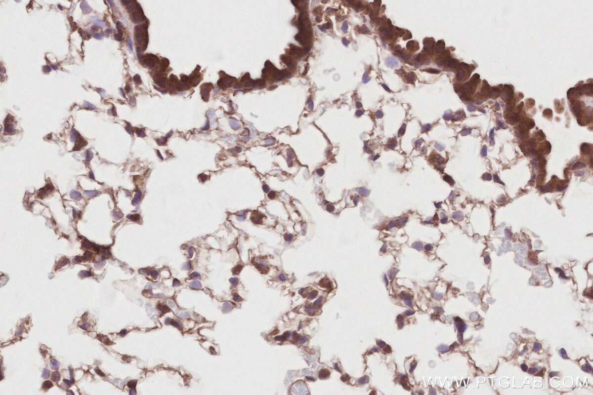 Immunohistochemical analysis of paraffin-embedded mouse lung tissue slide using KHC2885 (DUSP16 IHC Kit).