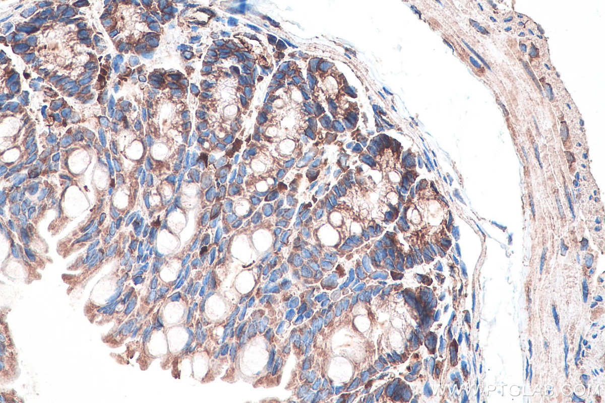 Immunohistochemical analysis of paraffin-embedded mouse colon tissue slide using KHC0124 (DVL2 IHC Kit).