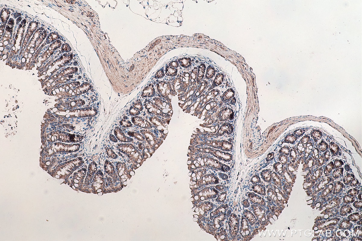 Immunohistochemical analysis of paraffin-embedded mouse colon tissue slide using KHC0125 (DVL3 IHC Kit).