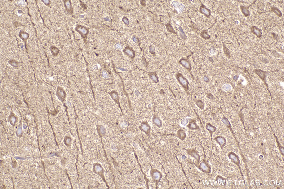 Immunohistochemical analysis of paraffin-embedded rat brain tissue slide using KHC2455 (DYNC1H1 IHC Kit).