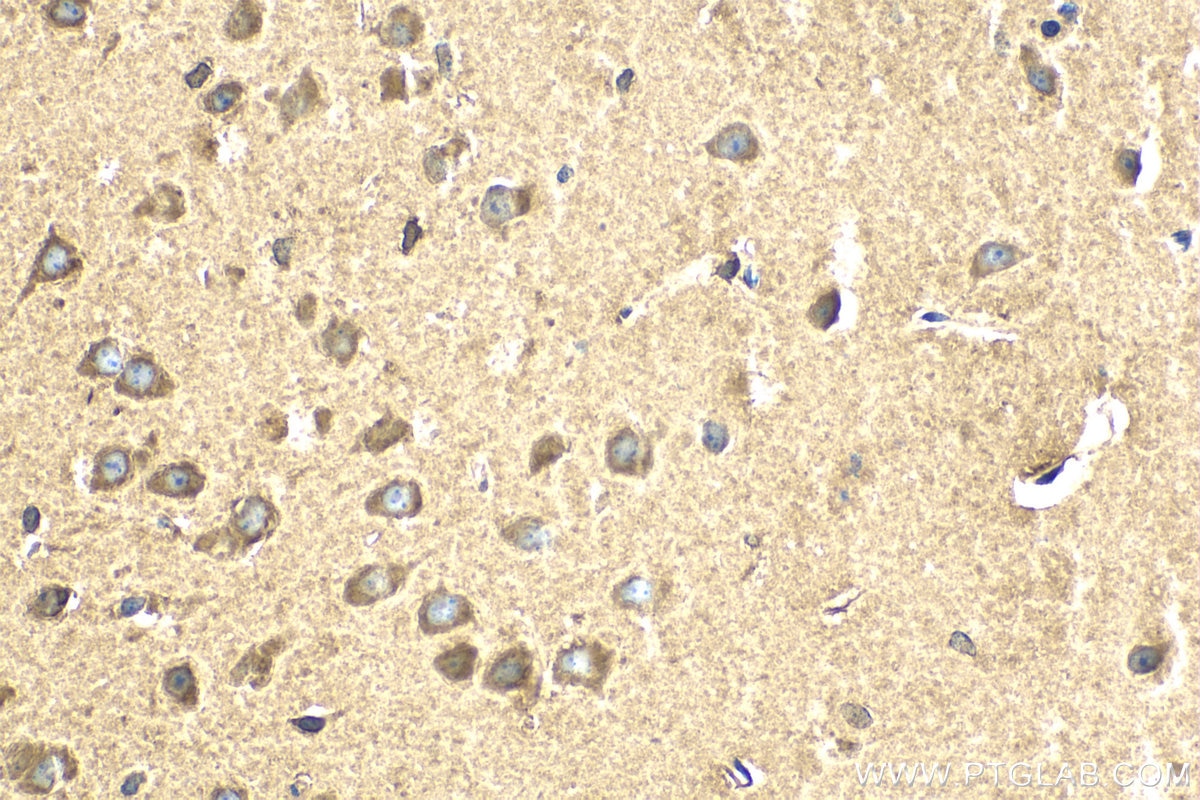 Immunohistochemical analysis of paraffin-embedded mouse brain tissue slide using KHC2055 (DYNC1I1 IHC Kit).