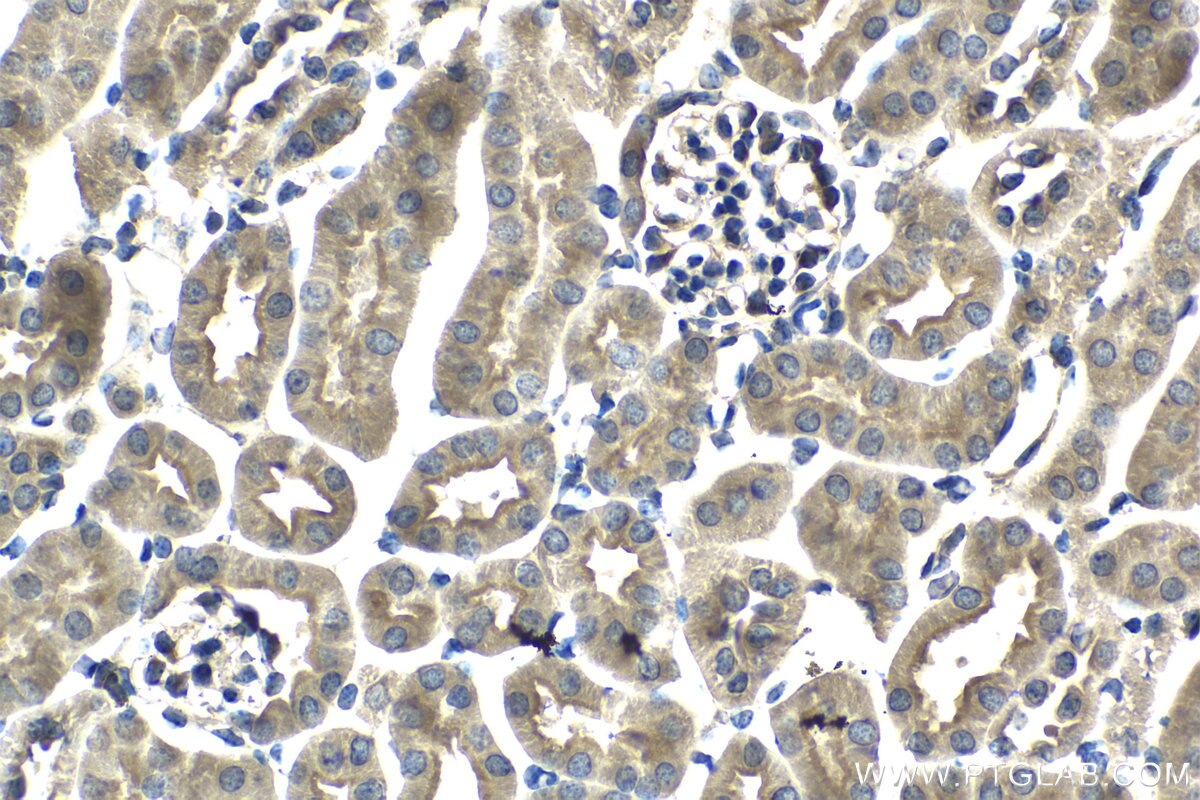 Immunohistochemical analysis of paraffin-embedded mouse kidney tissue slide using KHC2055 (DYNC1I1 IHC Kit).