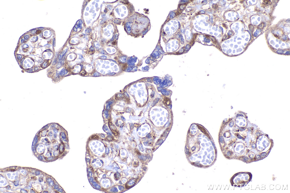 Immunohistochemical analysis of paraffin-embedded human placenta tissue slide using KHC2074 (DYNC1LI2 IHC Kit).