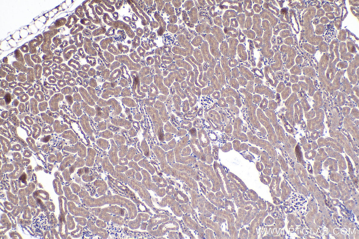 Immunohistochemical analysis of paraffin-embedded mouse kidney tissue slide using KHC2074 (DYNC1LI2 IHC Kit).