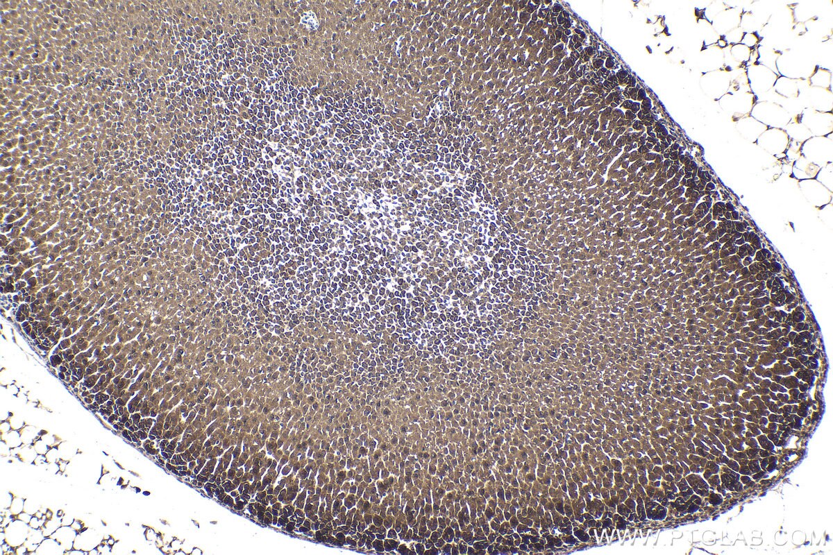 Immunohistochemical analysis of paraffin-embedded mouse adrenal gland tissue slide using KHC1812 (DZIP1 IHC Kit).