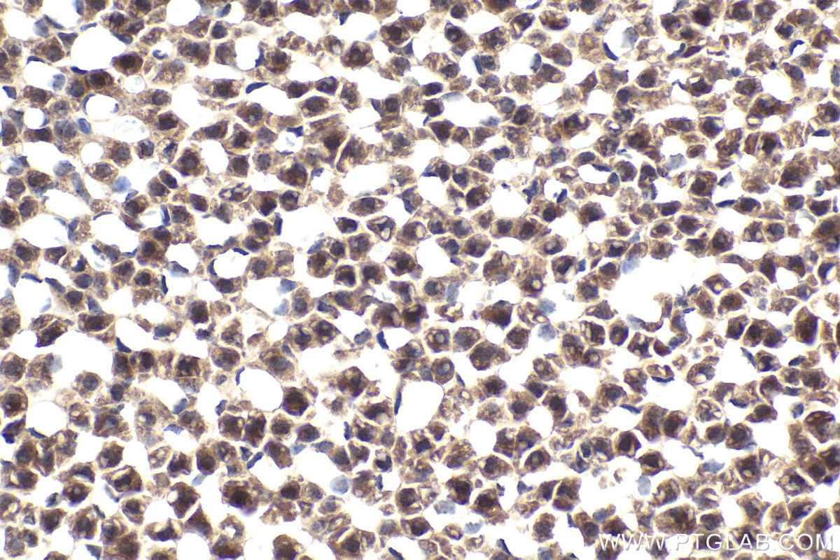 Immunohistochemical analysis of paraffin-embedded rat adrenal gland tissue slide using KHC1812 (DZIP1 IHC Kit).